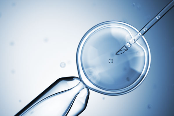 Revolutionizing Fertility Treatments: Intracytoplasmic Sperm Injection