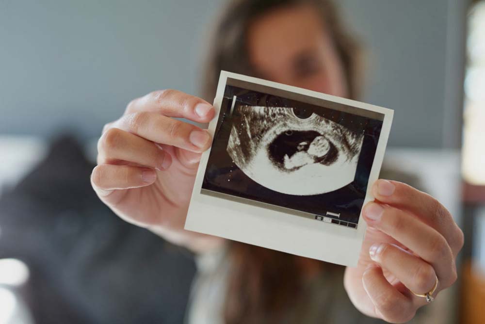 Woman holding ultrasound