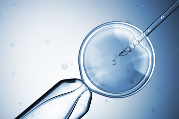 Tubal-Ligation-Reversal